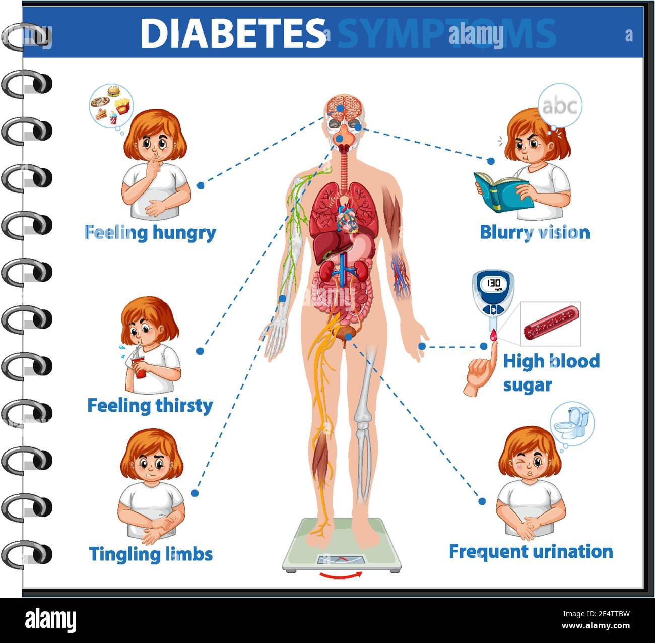 Informazioni sui sintomi del diabete illustrazione infografica ...