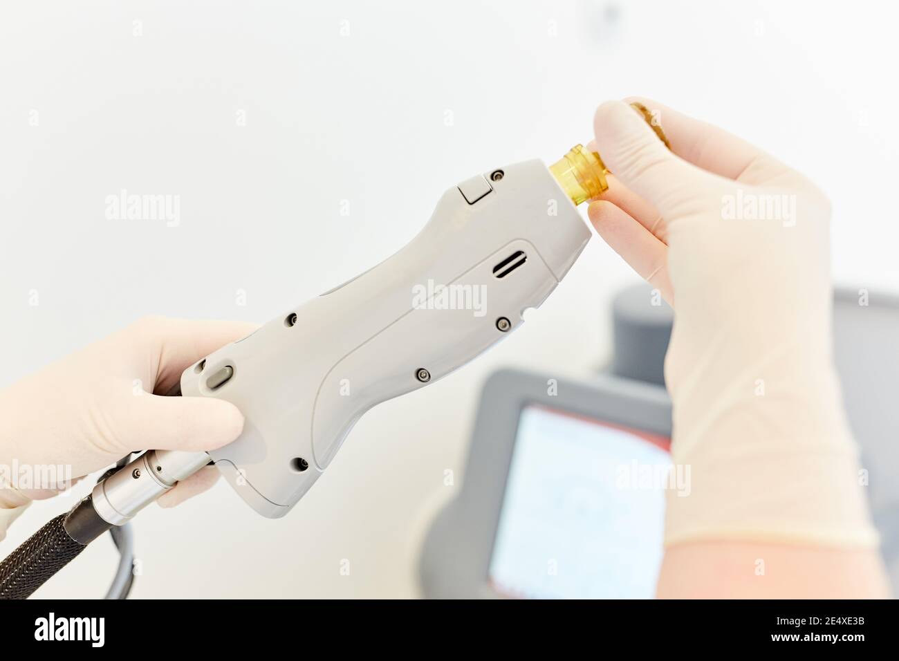 La mano con guanti monouso prepara il laser alexandrite per il laser epilazione Foto Stock