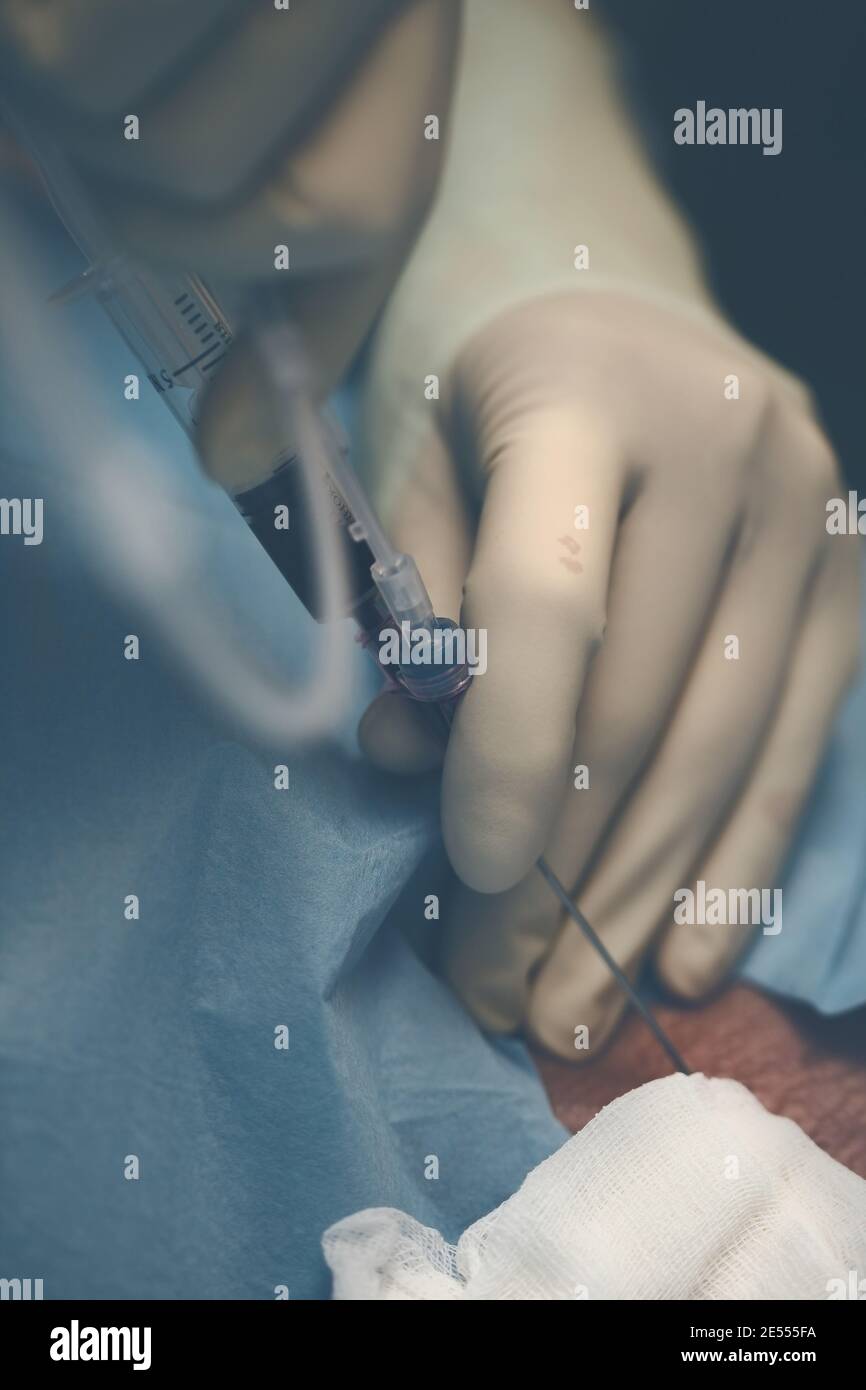 Il medico preleva un campione di sangue del paziente. Foto Stock