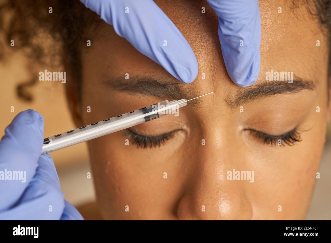 Primo piano di iniezione cosmetica alla bella giovane faccia femminile isolato su sfondo beige. Bellezza, concetto di cosmetologia. Shot orizzontale Foto Stock