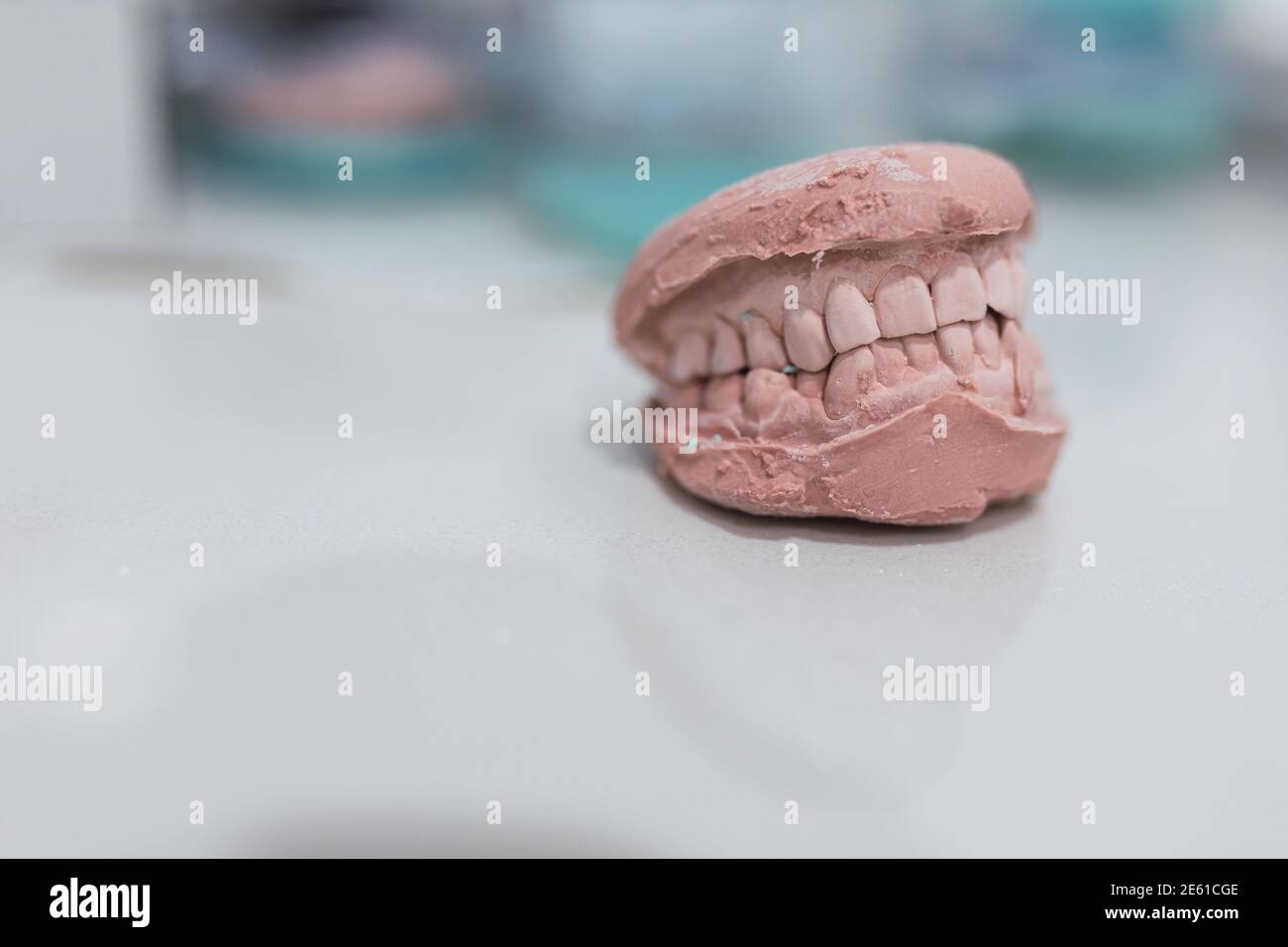 Casting dentale modello gesso gesso calco stomatologico mascelle umane laboratorio protesico, tecnico shots.dental concetto di salute. Foto Stock
