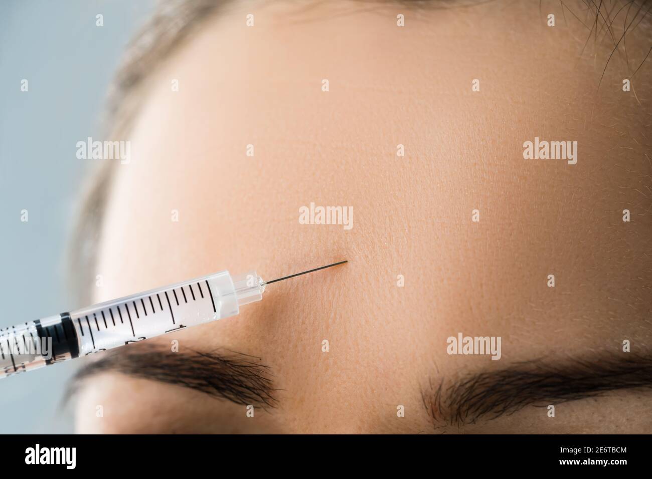 Collagene fronte sollevamento viso iniezione Beauty trattamento Foto stock  - Alamy