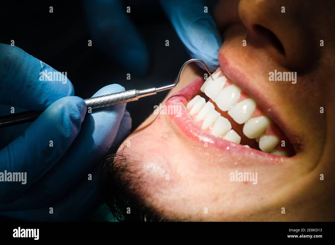 Un giovane paziente di sesso maschile prende una presenza dentale nell'ufficio del dentista. Foto Stock