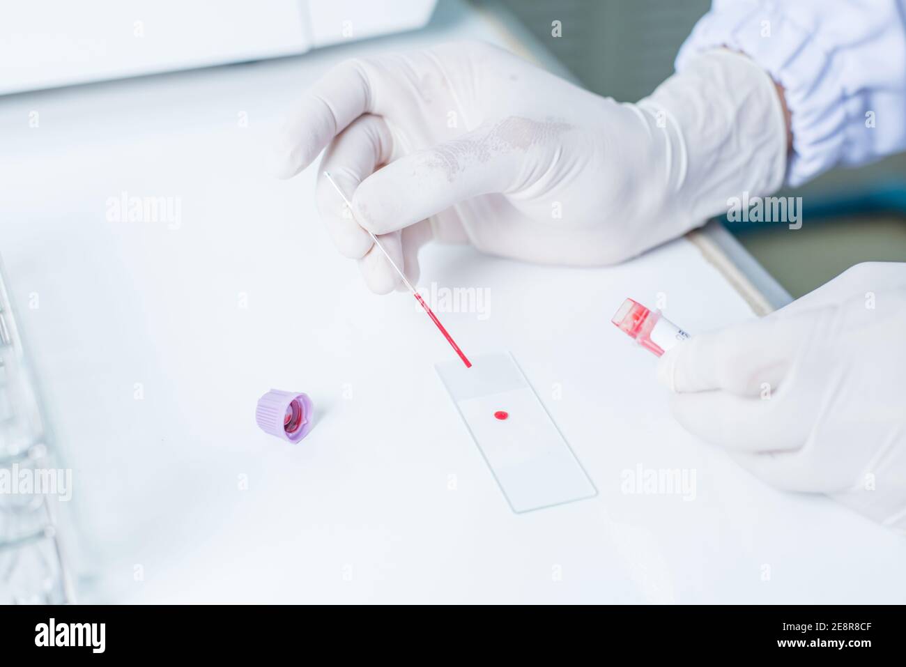 Campionamento del sangue con ago per analisi in laboratorio Foto Stock