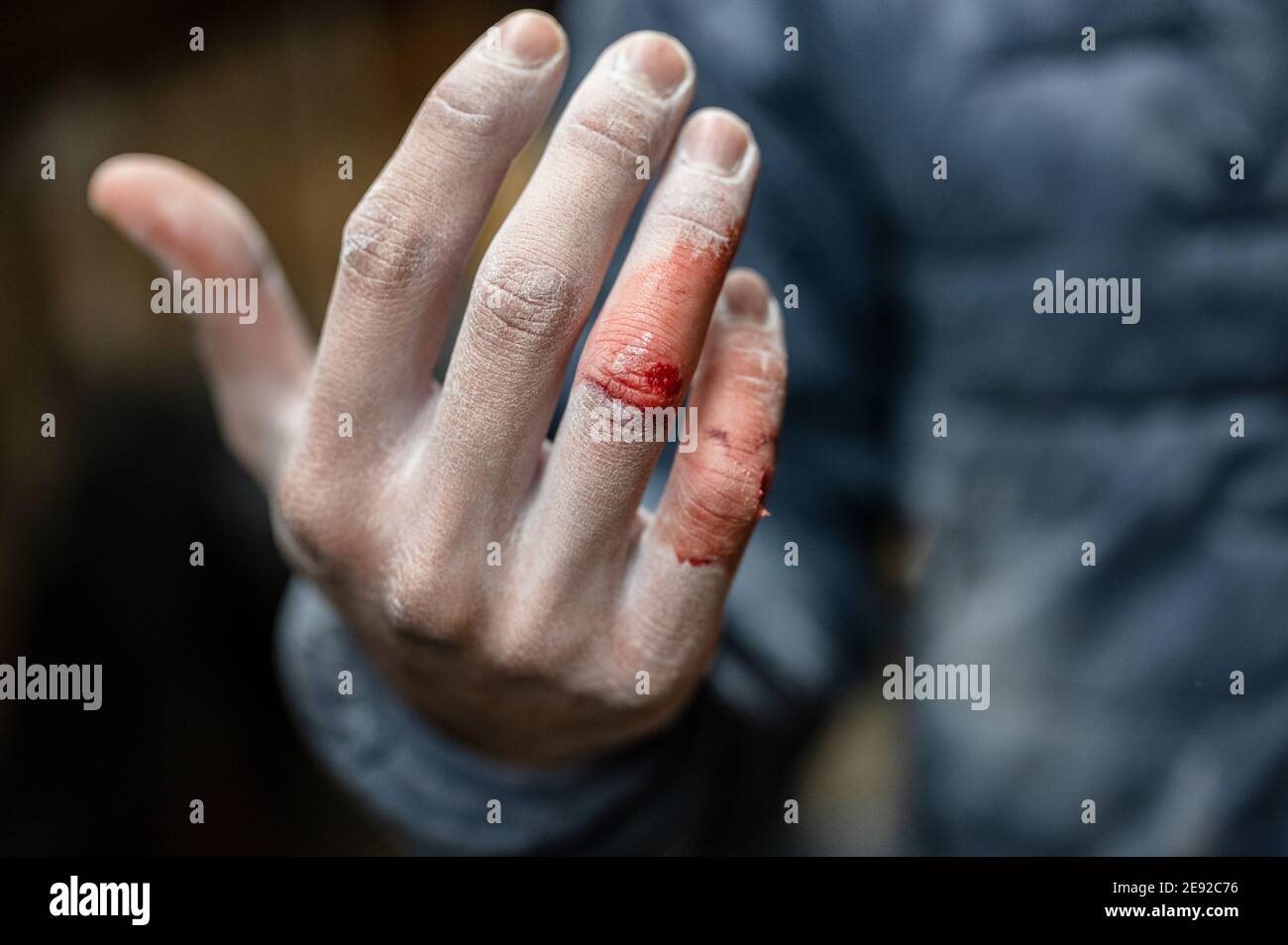 Una mano destra sanguinosa di un maschio che indossa un maglione Foto Stock
