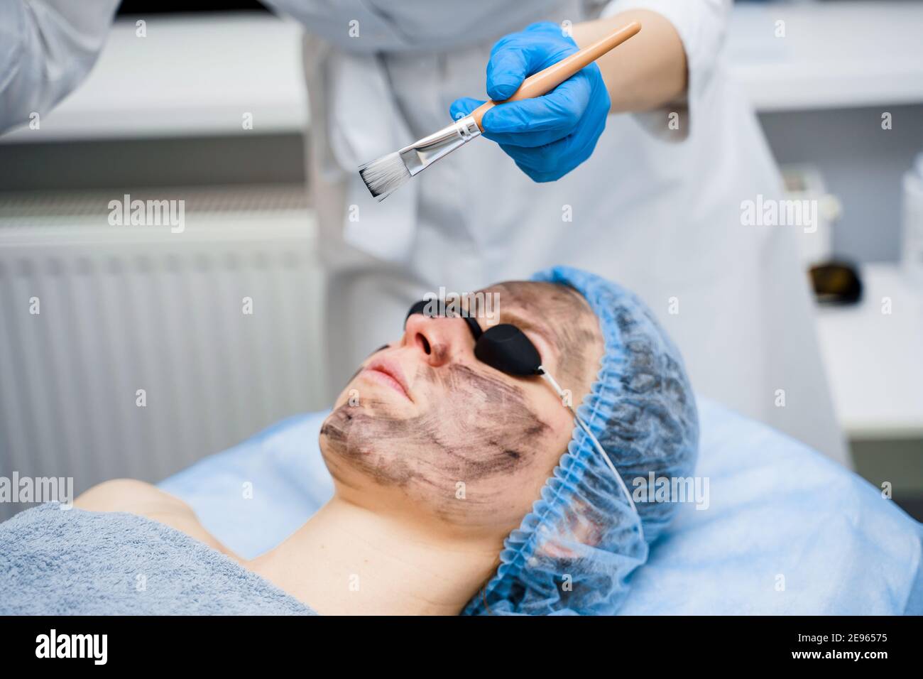 Il dermatologo ha strisciato la maschera nera sul viso per  fotorejuvenazione laser e peeling al carbonio. Dermatologia e cosmetologia.  Utilizzo del laser chirurgico Foto stock - Alamy