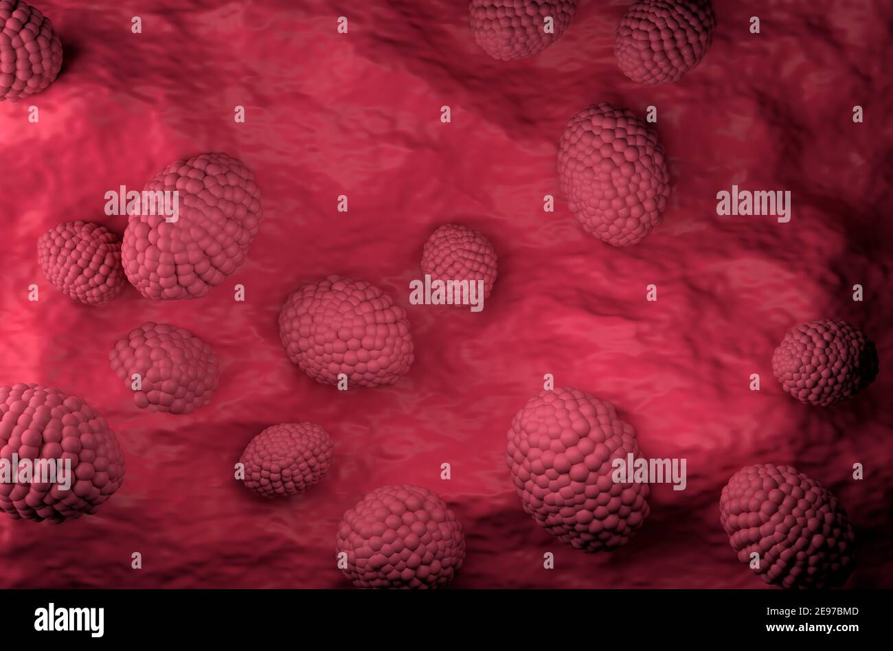 Visualizzazione dall'alto delle cellule tumorali della prostata in 3d Foto Stock
