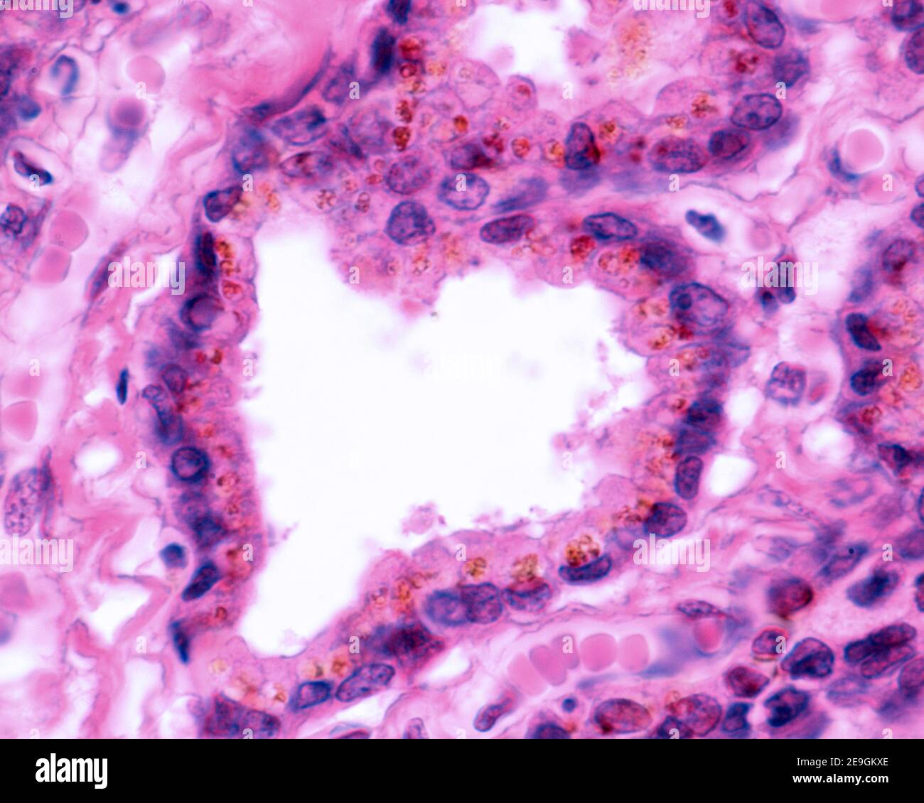 Epitelio secretorio della vescicola seminale. È un epitelio colonnare, che mostra un pigmento giallo-dorato altamente caratteristico. Foto Stock