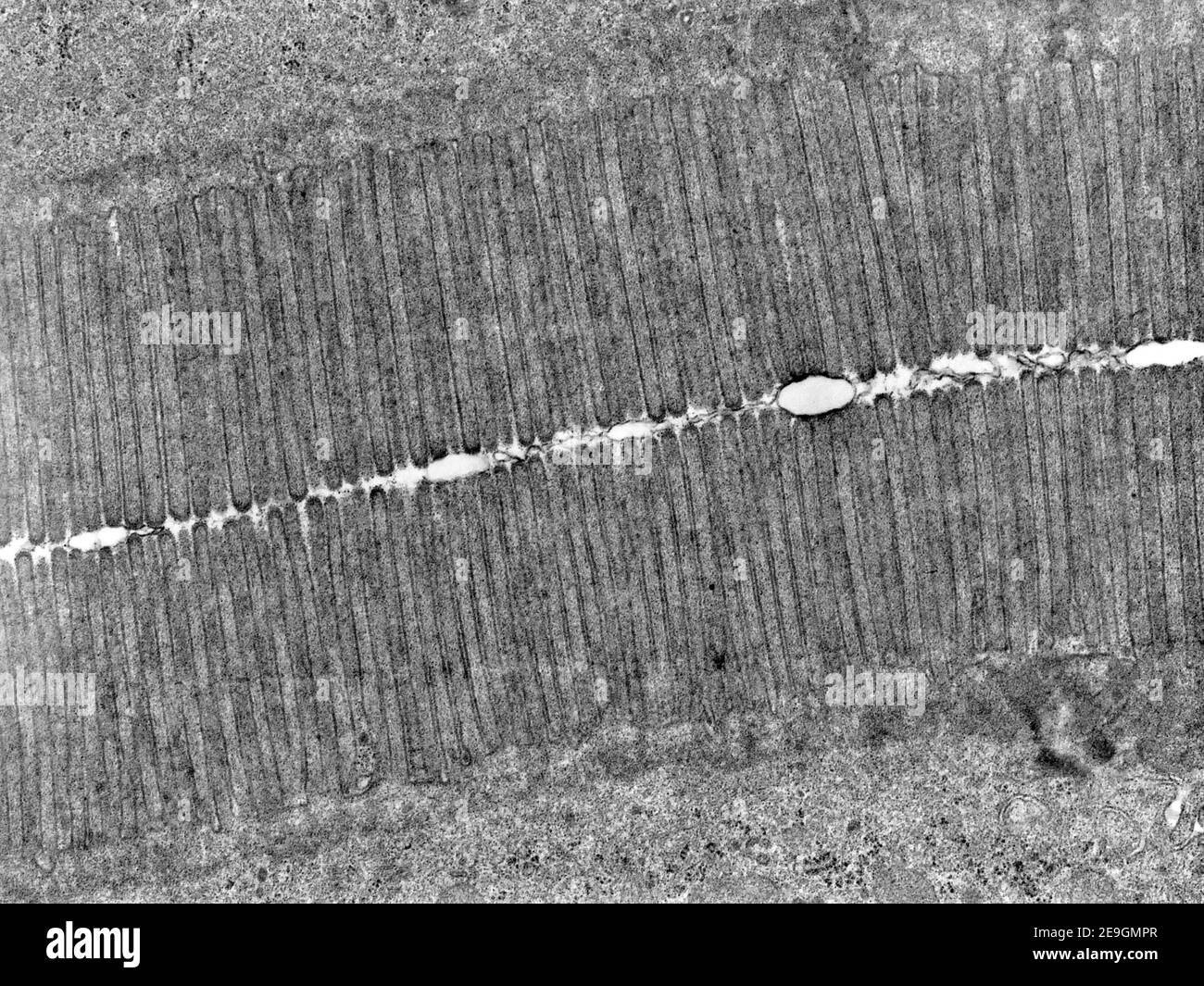 Micrografia al microscopio elettronico a trasmissione (TEM) che mostra il bordo di un pennello in sezione longitudinale. I microvilli di queste due cellule dell'intestino tenue ar Foto Stock