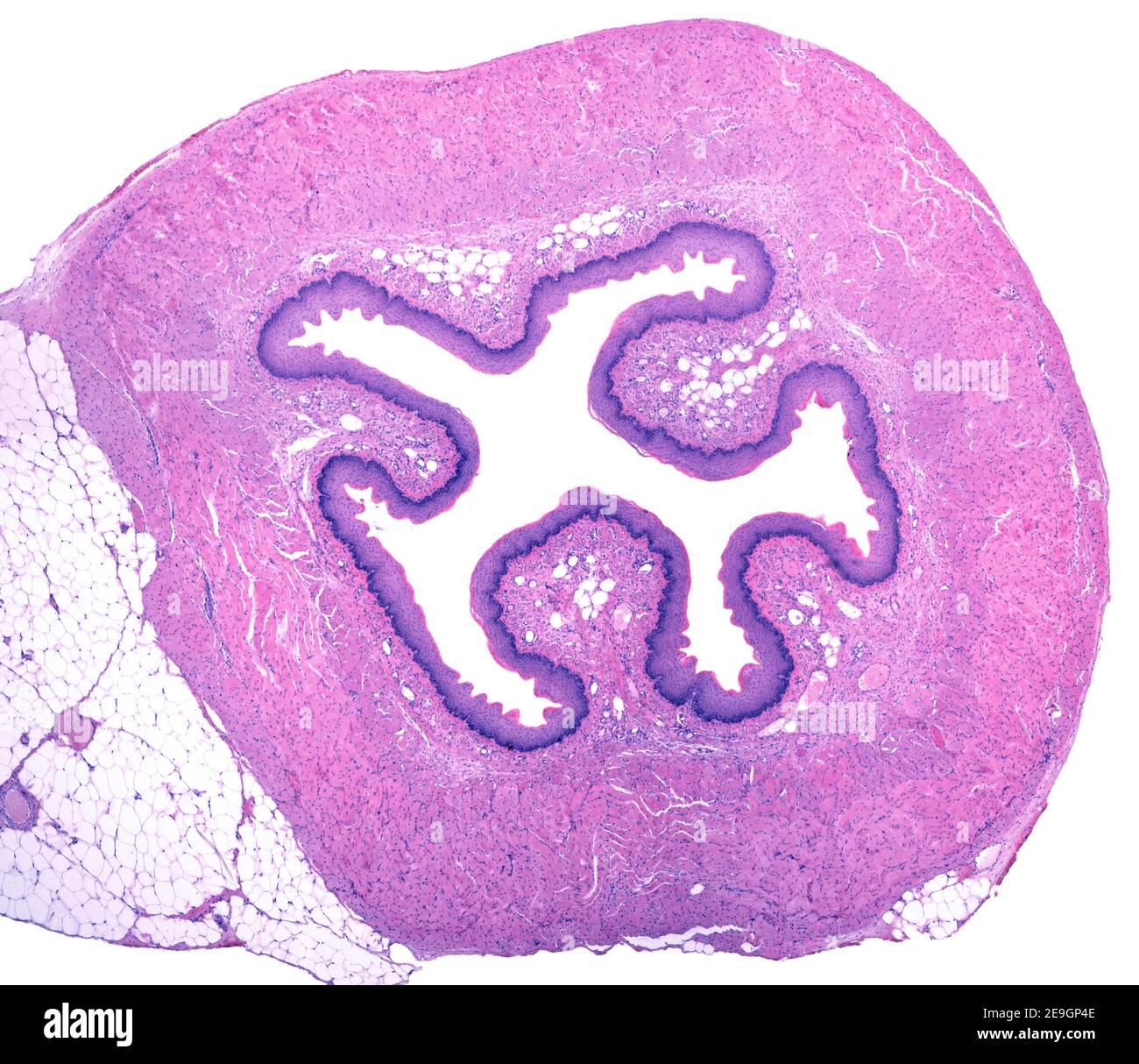 Micrografia a basso ingrandimento che mostra una sezione trasversale dell'esofago. La mucosa che riveste il lume centrale mostra pieghe coperte da uno scamoso stratificato Foto Stock