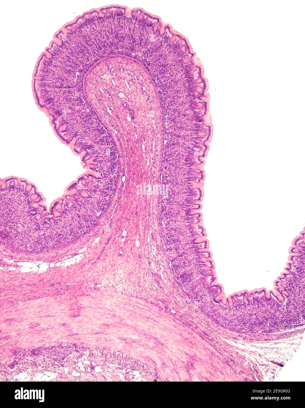 Piega della mucosa gastrica, il cui asse centrale è formato da sottomucosa. La mucosa mostra le cavità gastriche, le ghiandole fundiche e le mucose muscolariche. Foto Stock