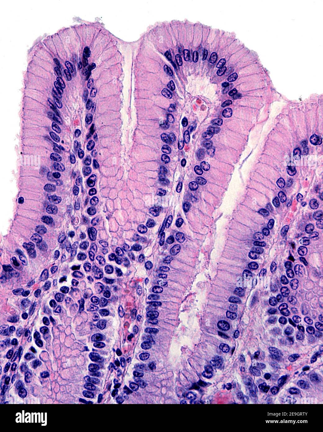 L'epitelio superficiale dello stomaco invagina per formare i pit gastrici. Le anse sono rivestite da un semplice epitelio colonnare formato da cellule mucose. Foto Stock