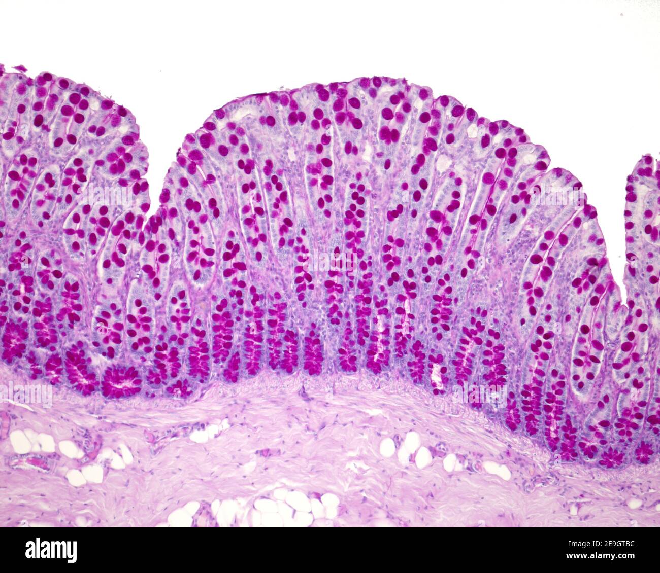 Parete dell'intestino crasso colorata con la tecnica PAS. Questo metodo ...