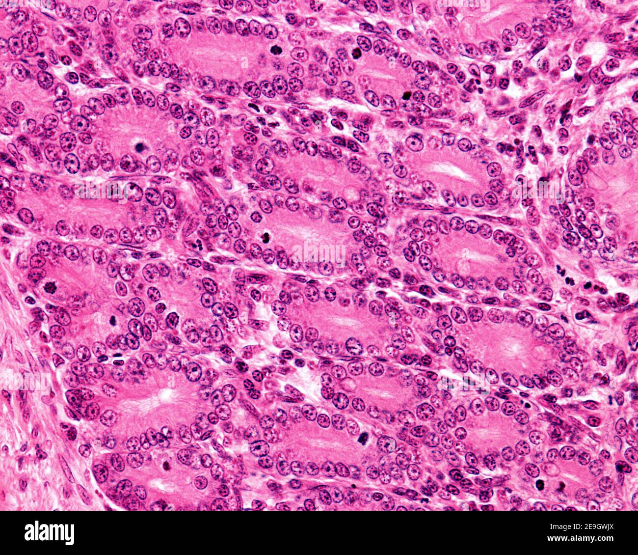 Cripte di Lieberkühn che mostrano abbondante mitosi nell'epitelio. Foto Stock