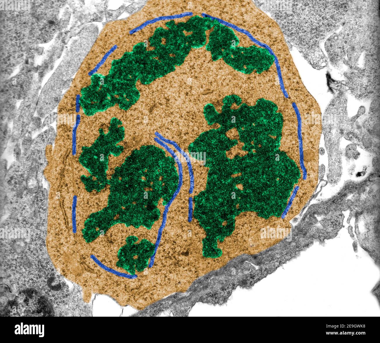 Micrografia TEM a falsi colori di una cellula mitotica in prometafase stadio che mostra cromosomi (verdi) e resti di inviluppo nucleare Foto Stock