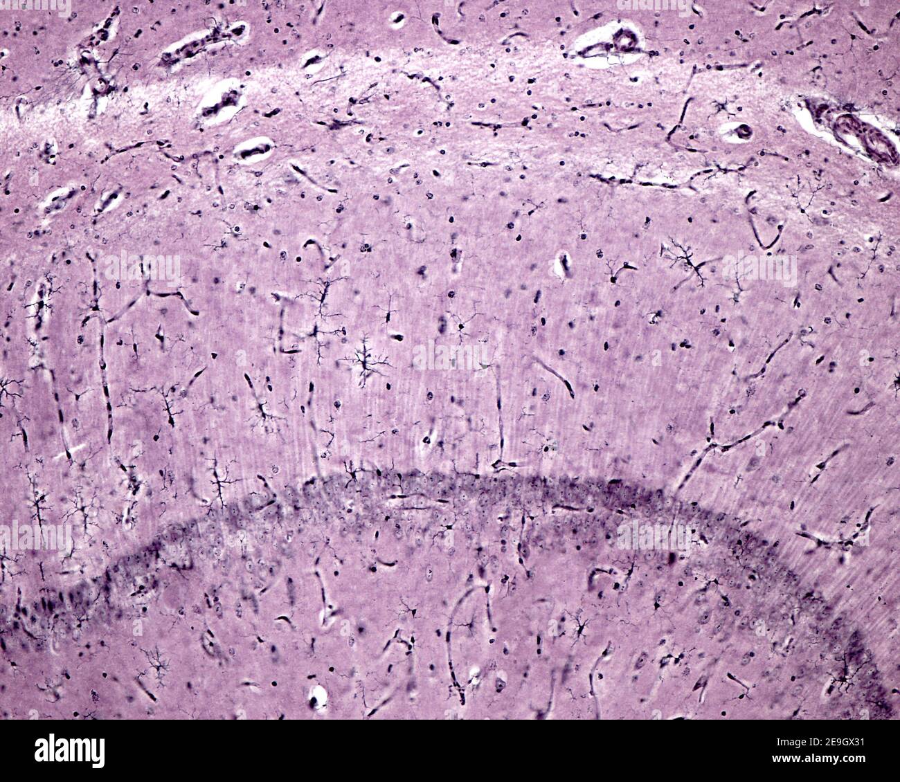 Cellule microgliali dell'ippocampo (Ammon Horn) dimostrate con il metodo Rio-Hortega (carbonato d'argento). Foto Stock