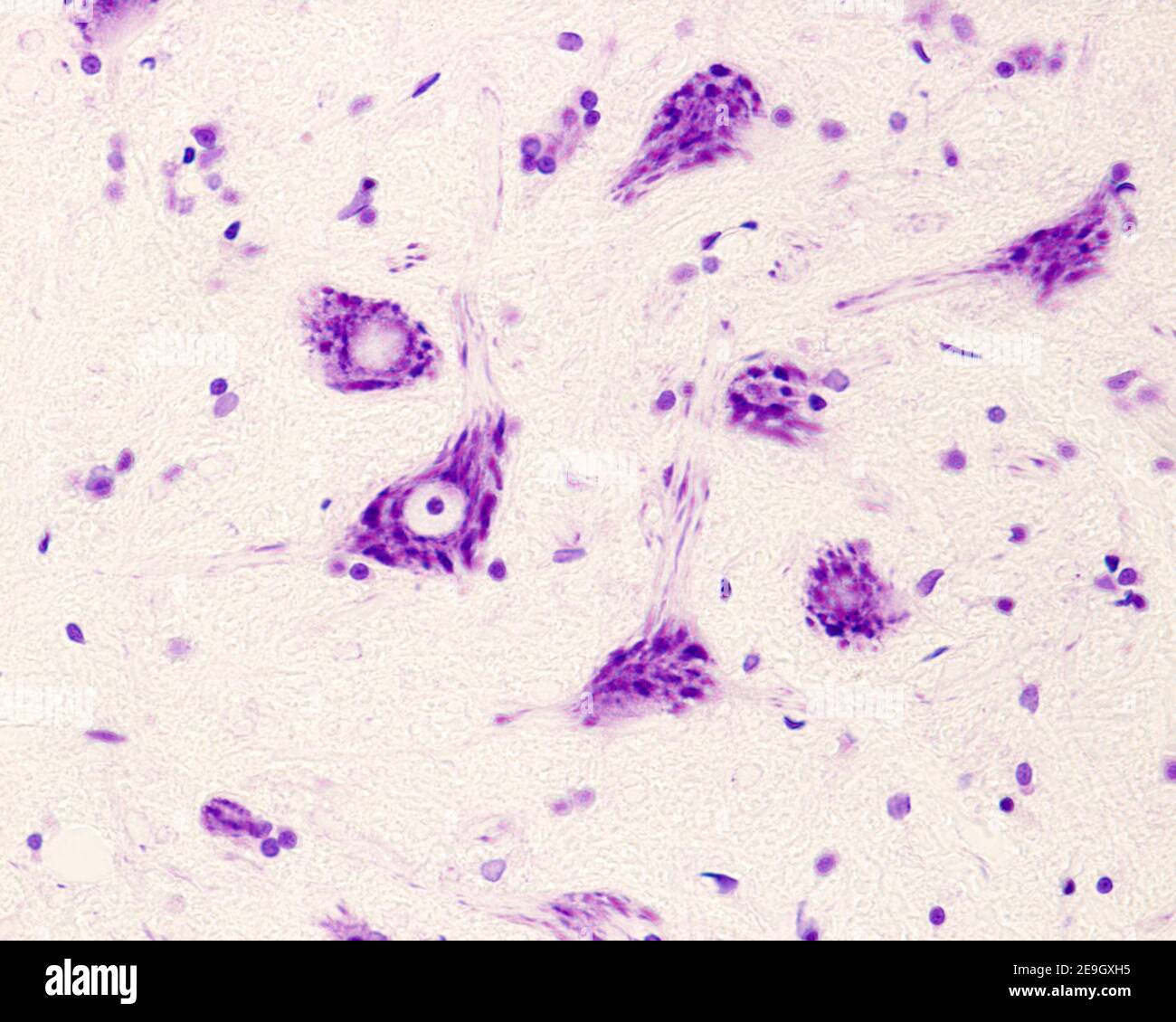 Neuroni motori del corno anteriore del midollo spinale Contengono nel loro citoplasma corpi Nissl grossolani e un Grande nucleo.Cresil violetto Foto Stock