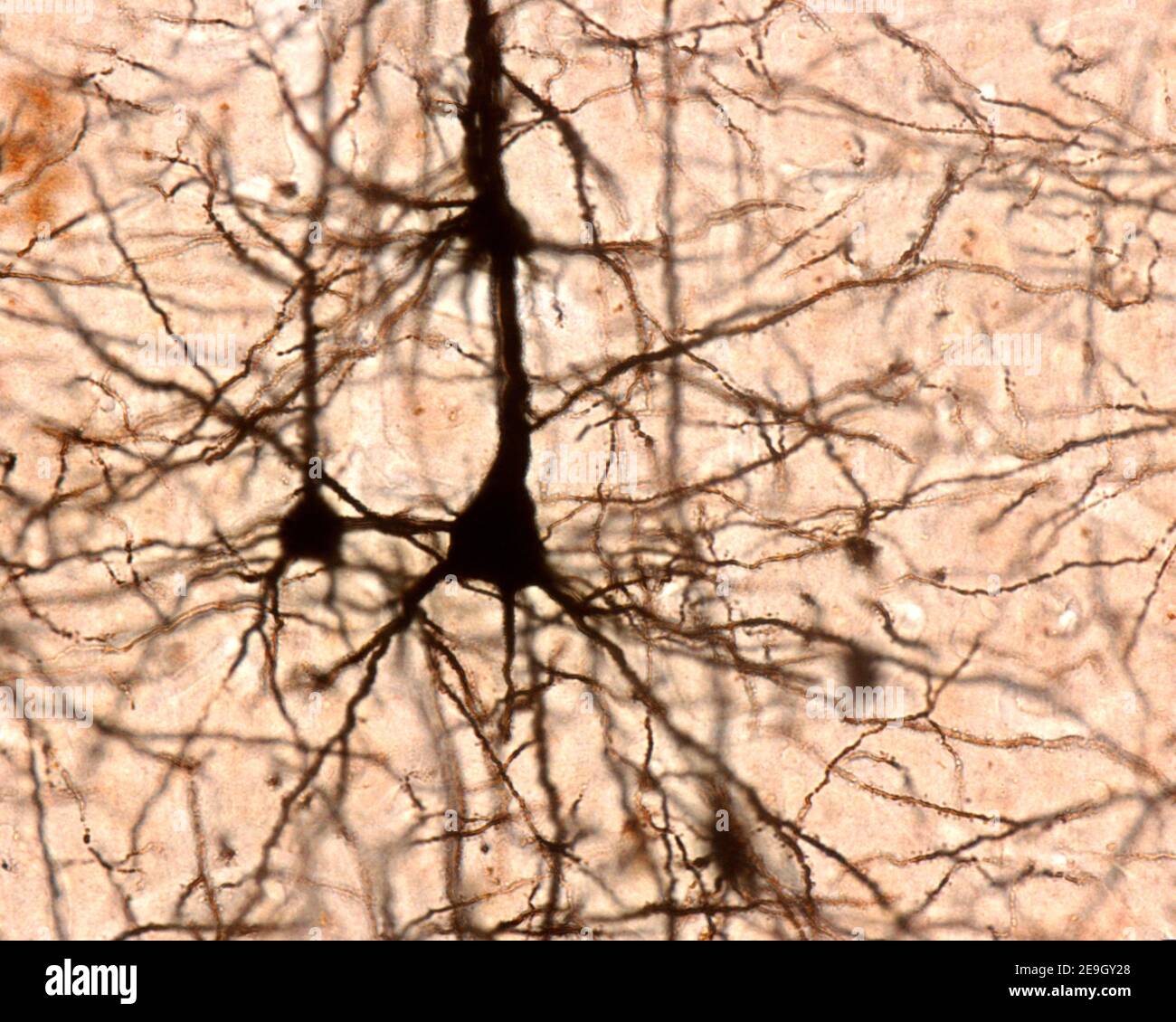 Neuroni piramidali della corteccia cerebrale. Il cromato d’argento di Golgi. Dal soma a forma conica, una grande dendrite apicale e più dendriti basilari Foto Stock
