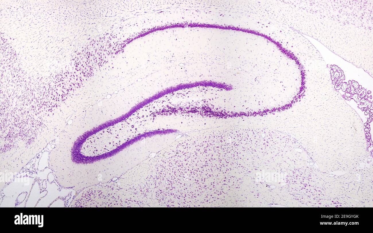 Vista panoramica dell'ippocampo (allocortex), esempio di archicortice, che mostra il corno Ammon (lettera C aperta a sinistra) e il gyrus dentato Foto Stock