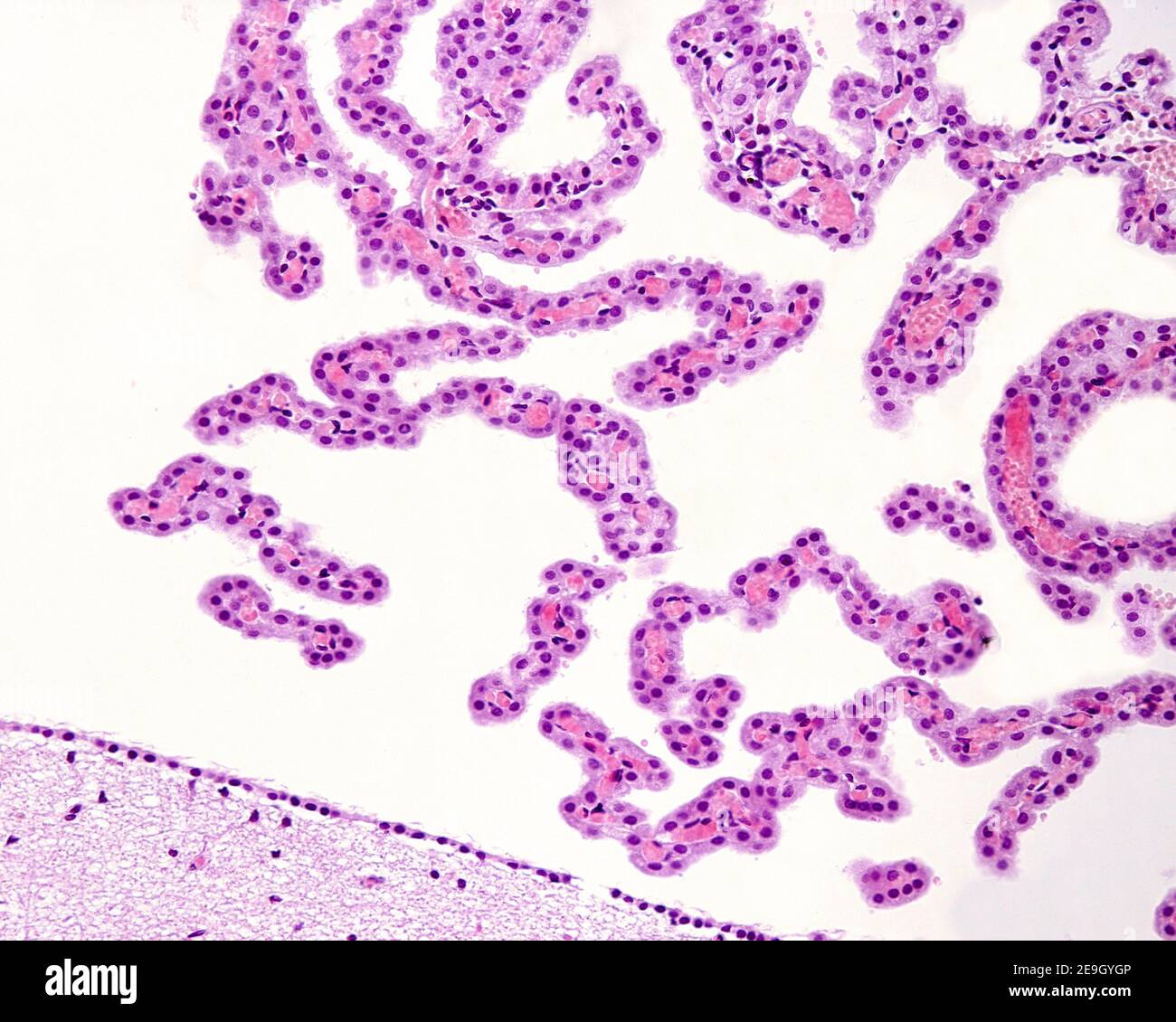 Plesso coroide del quarto ventricolo rivestito da cellule cubiche, poggiato su un asse stretto di tessuto connettivo sciolto con numerosi capillari del sangue Foto Stock