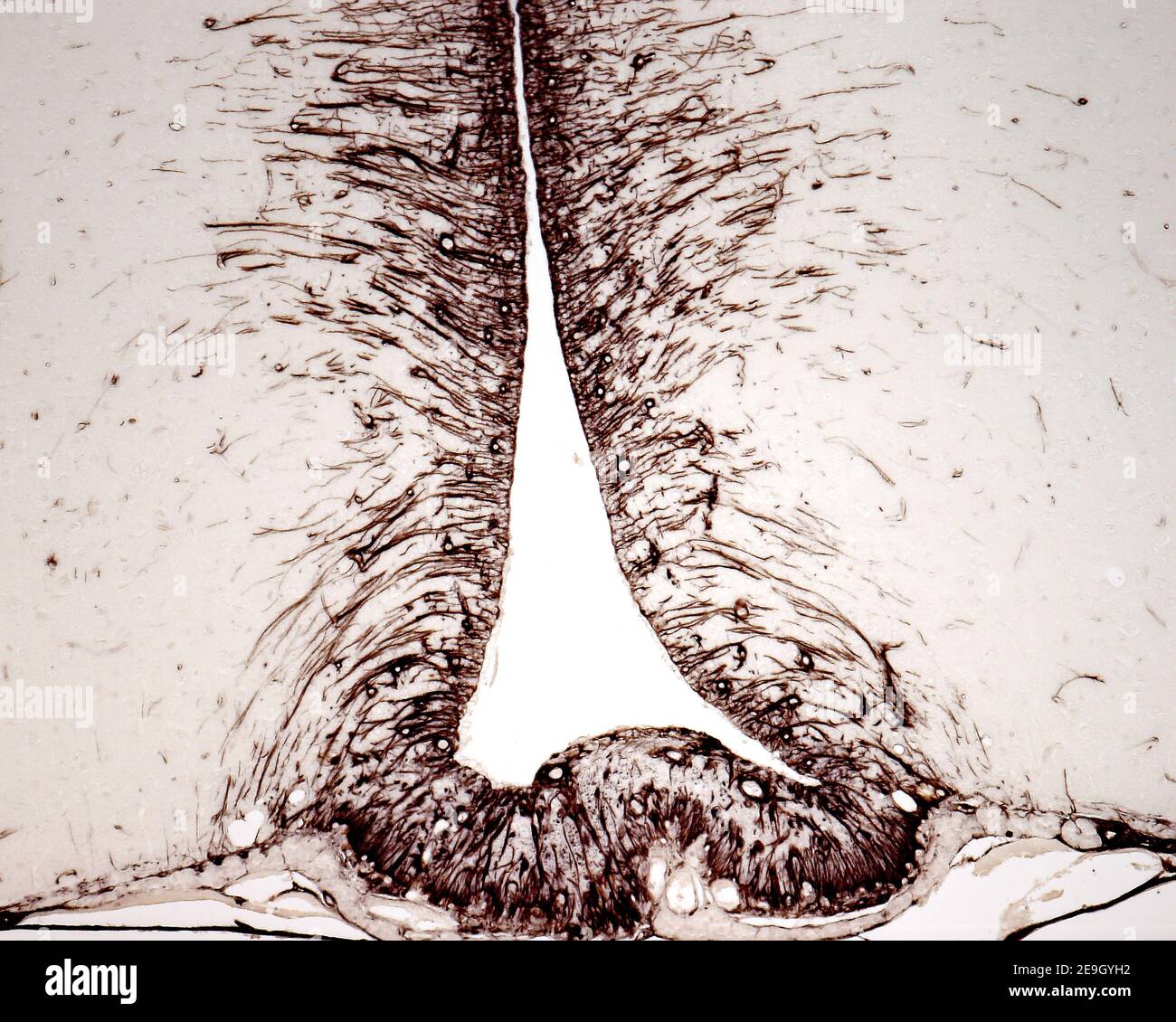 Tanyciti nel pavimento del terzo ventricolo colorati con tecniche immunoistochimiche per la vimentina. Foto Stock