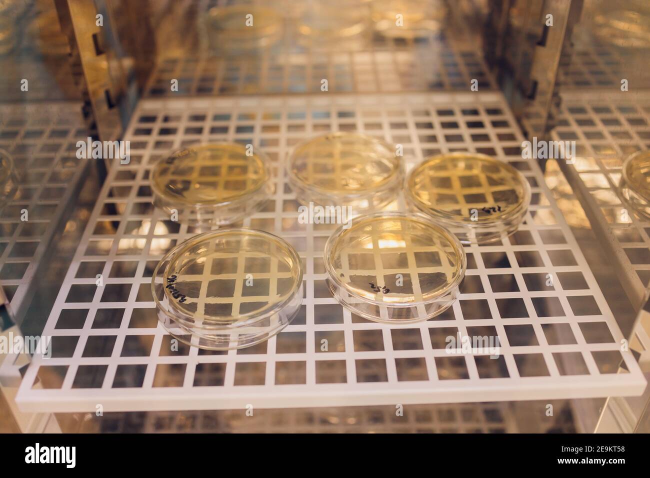 E. coli che cresce su una piastra peri. Prelevato da un campione di lattuga Foto Stock