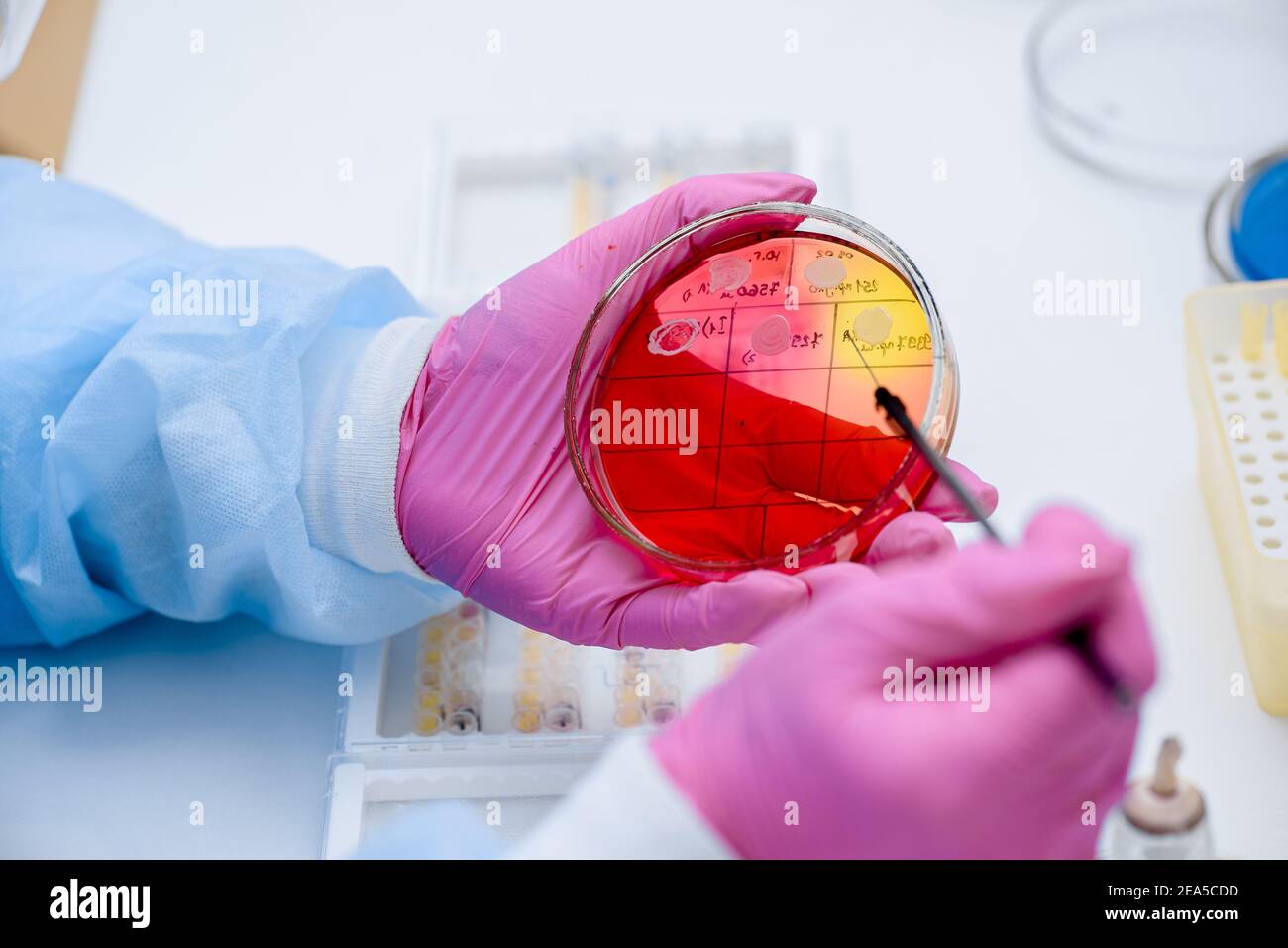 Primo piano della coltura di inoculazione batterica in una capsula di Petri. Analisi batterica di laboratorio Foto Stock