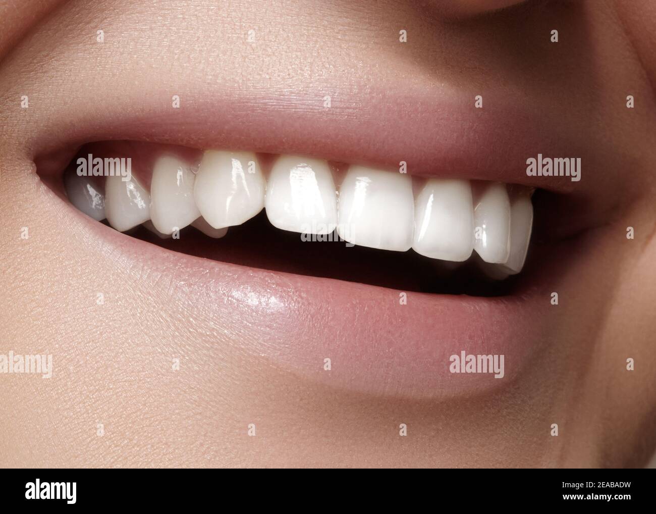 Bel sorriso con denti sbiancanti. Foto dentale. Macro closeup di perfetta bocca femminile, rutina lipscare. Foto Stock