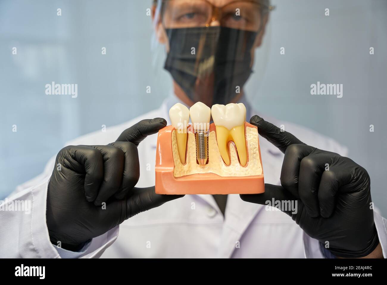Dentista serio che mostra un modello di denti con impianto a telecamera Foto Stock