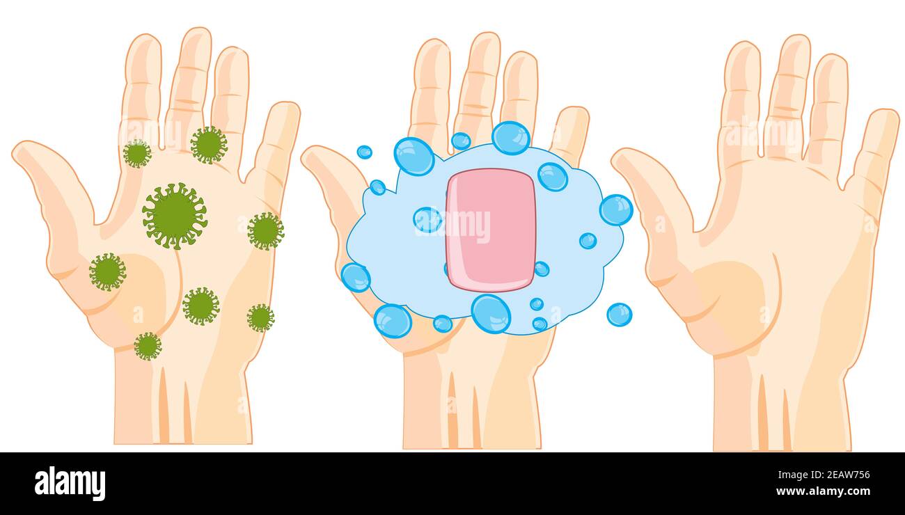 Igiene delle mani della mano con virus e. pulire dopo il lavaggio Foto Stock