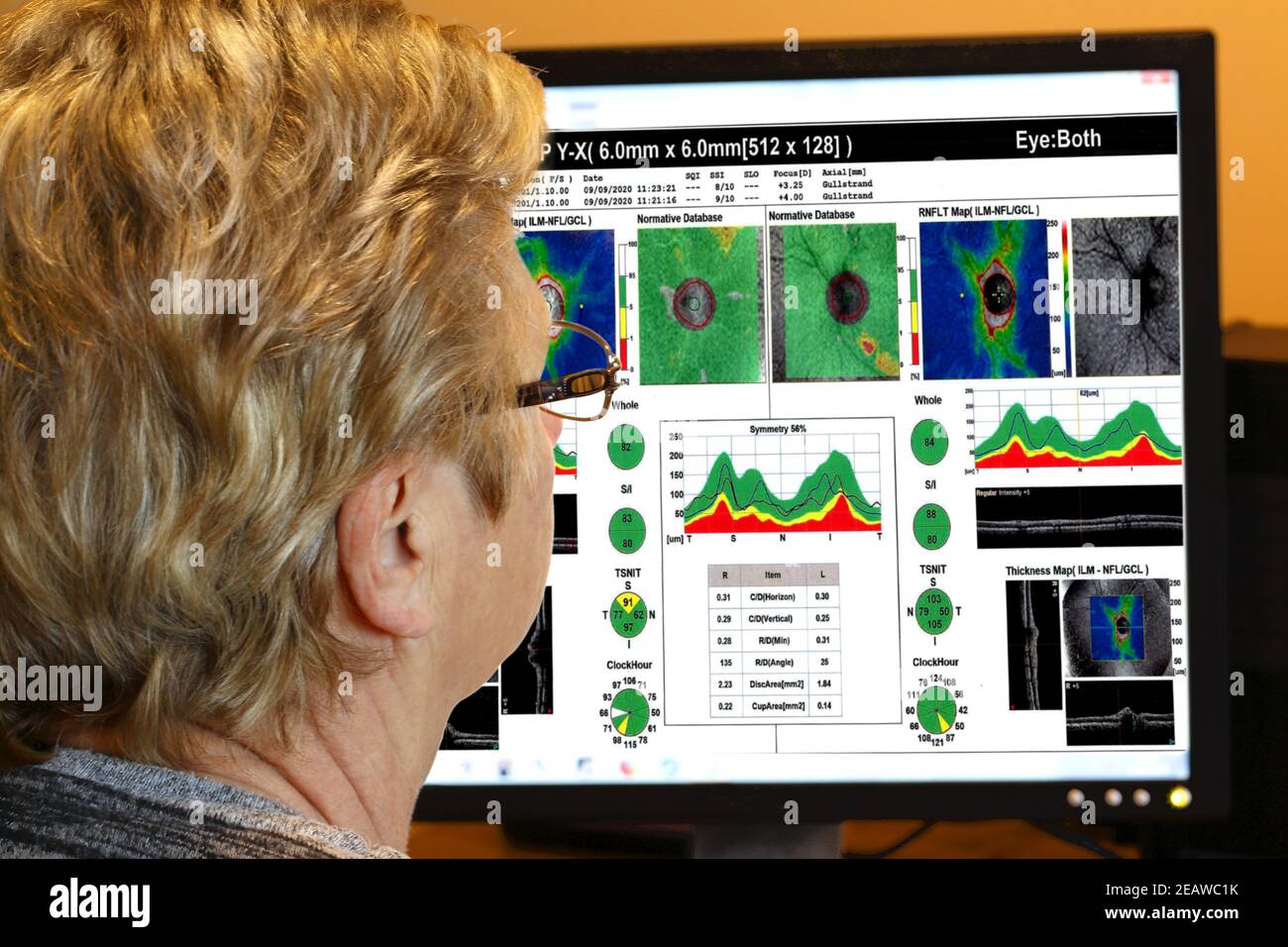 Specialista degli occhi femminile, (posato dal modello), che guarda le scansioni da un test degli occhi sullo schermo di un computer Foto Stock
