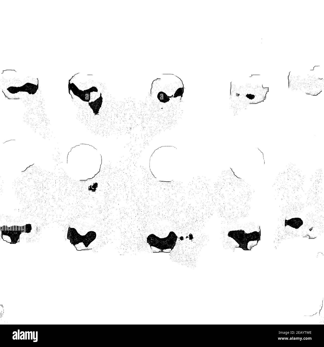 Luce Sfondo Distessato. Sfondo Di Emergenza Di Stampa Dell'Inchiostro. Grunge Texture. Foto Stock