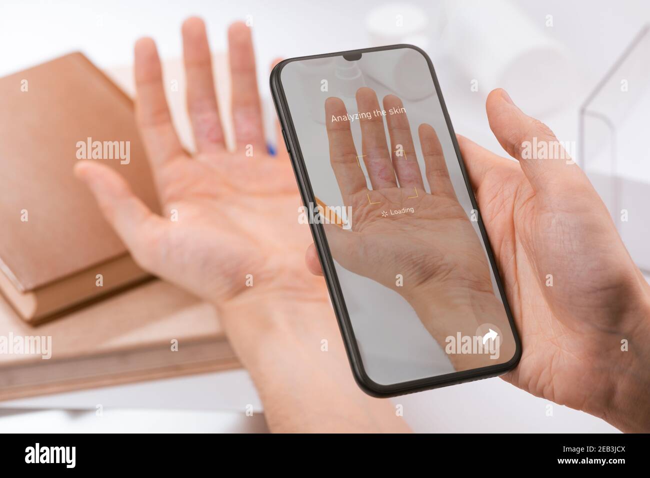 Uomo che usa un'app per il telefono per riconoscere una malattia su lato interno delle dita Foto Stock