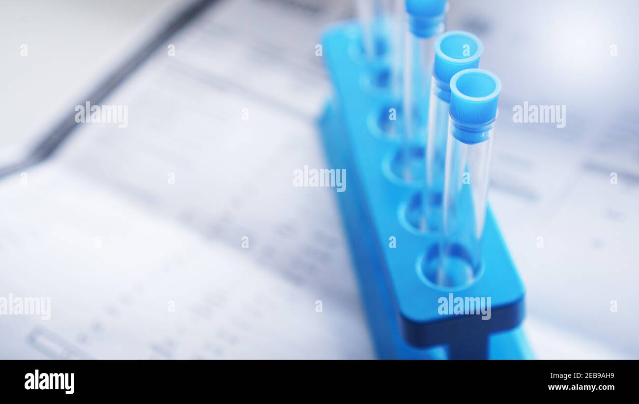 Provette su un supporto blu su uno sfondo di fogli sfocati con risultati del test. Concetto di laboratori chimici. Foto Stock