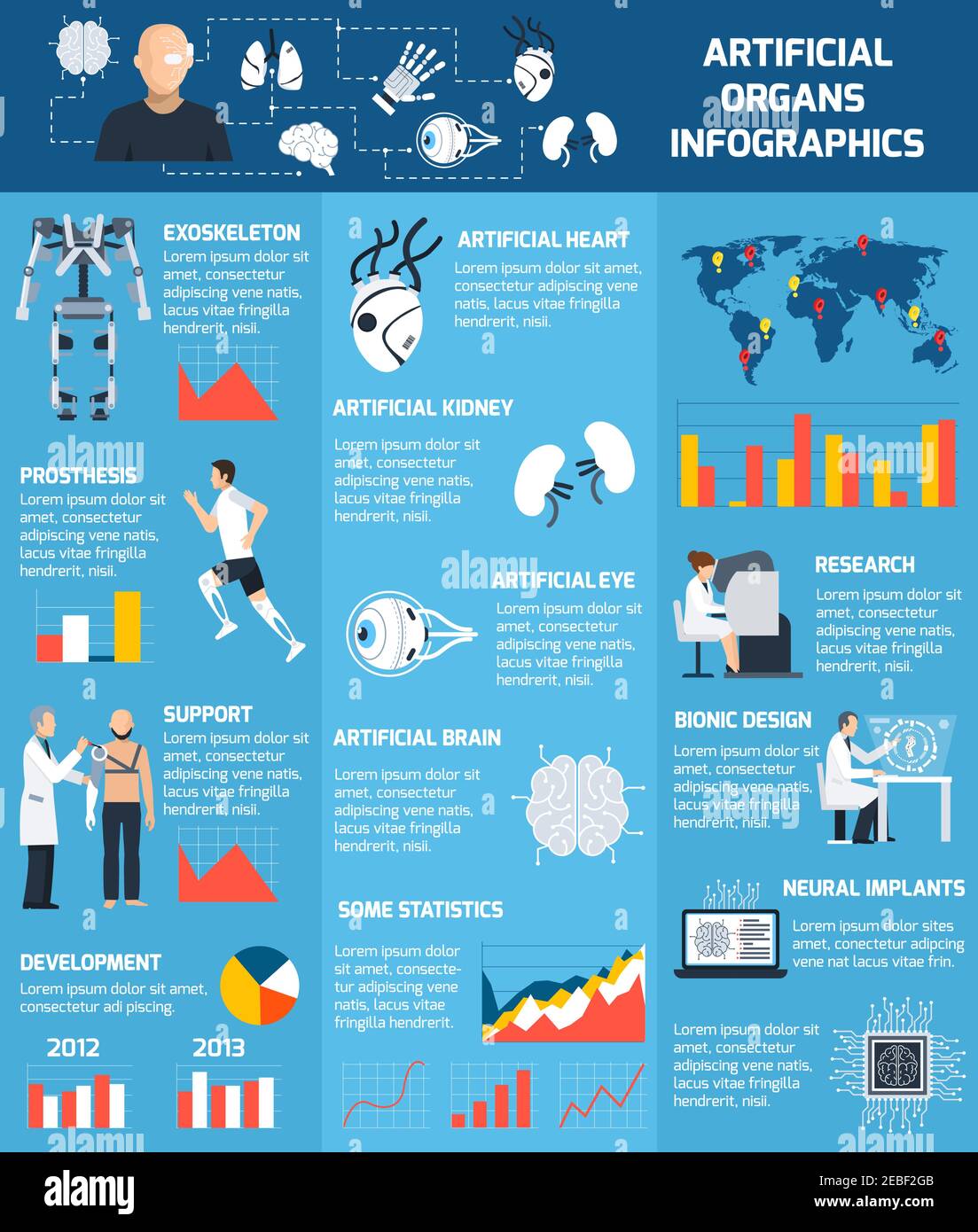Infografiche di organi artificiali bioniche con diverse parti del corpo che possono essere impiantato in un'illustrazione vettoriale di stile piatto Illustrazione Vettoriale