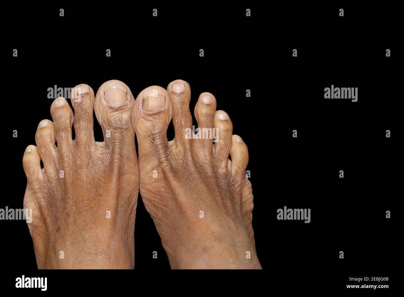 Immagine in primo piano dei piedi umani maschi in sfondo nero isolato Foto Stock