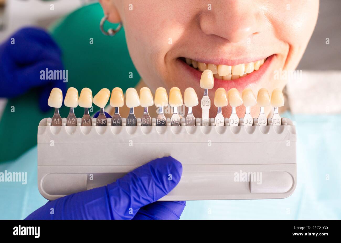 Giovane donna alla consultazione dentista. Controllo e trattamento dentale in una clinica dentale. Igiene orale e trattamento. Foto Stock