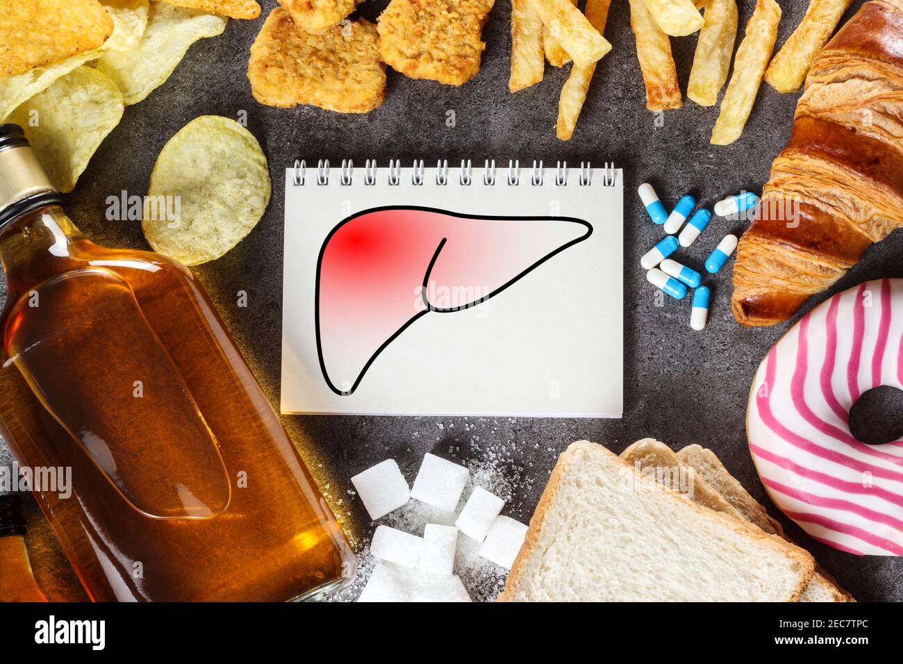 Stile di vita e abitudini malsane - rischio di danni al fegato. Vista dall'alto Foto Stock