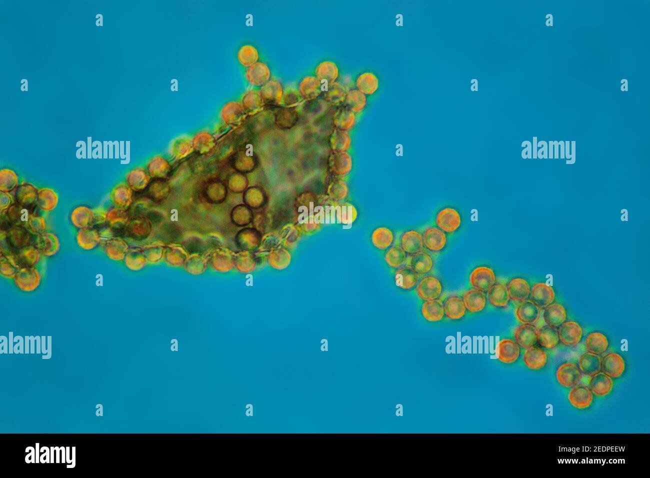 Spore di un fungo, MRI a contrasto di fase Foto Stock