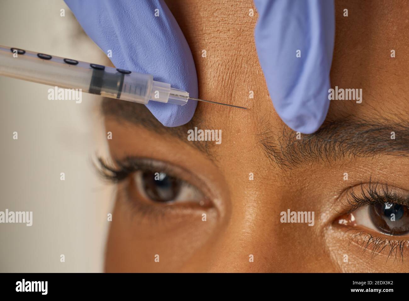 Primo piano ritratto di bella giovane donna ottiene iniezioni viso isolato su sfondo beige. Bellezza, concetto di cosmetologia Foto Stock