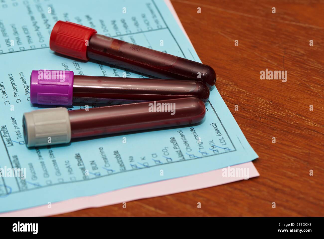 Tre campioni di sangue nelle provette e nel modulo di richiesta del medico per l'esame biochimico Foto Stock