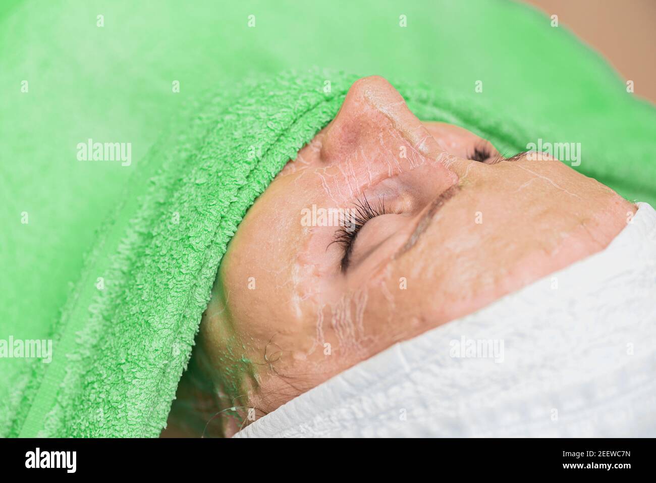 Il processo di ammorbidimento della maschera enzimatica con un panno umido. Foto Stock