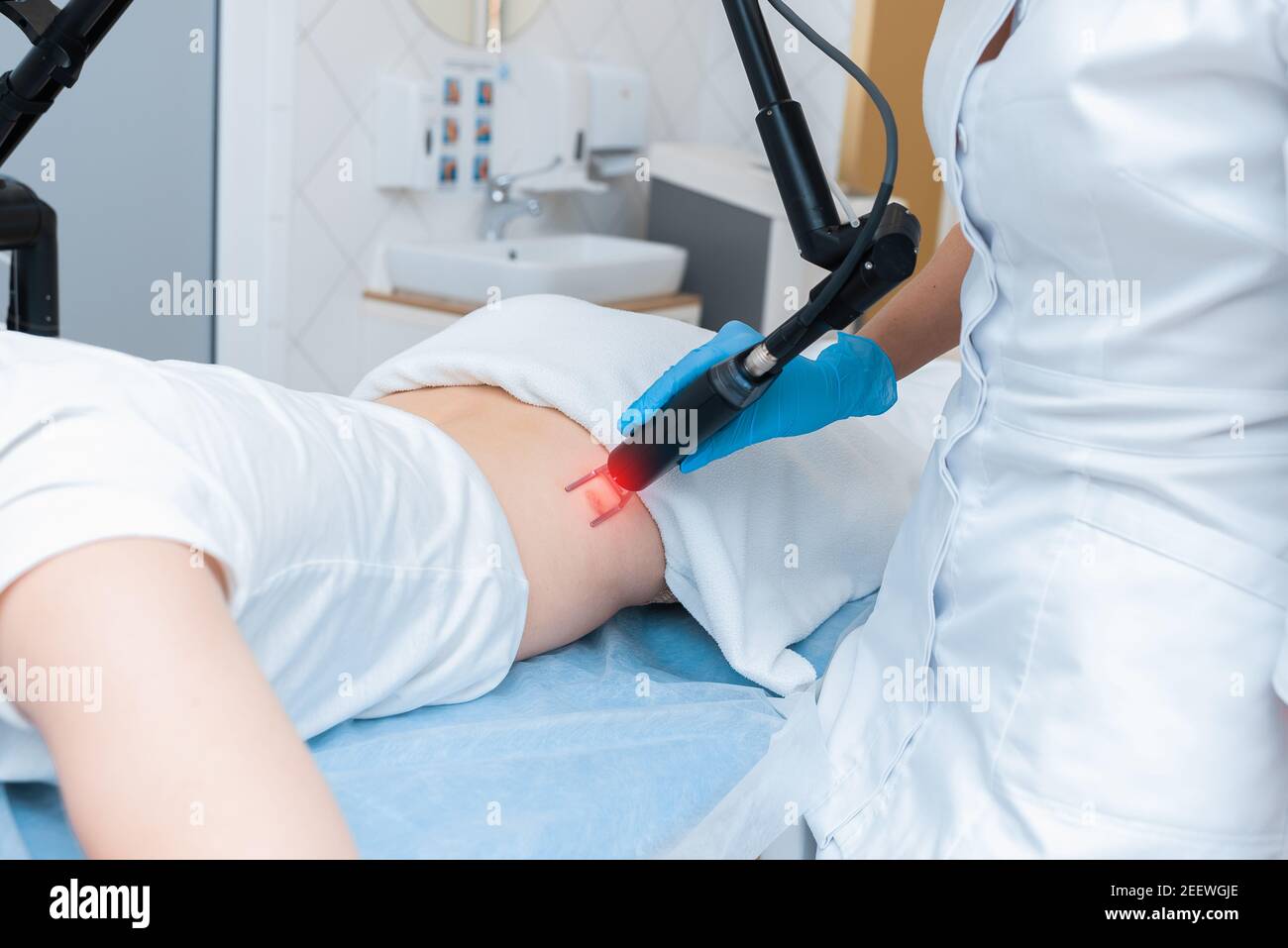 Rimozione hardware laser di una cicatrice in cosmetologia moderna. Foto Stock