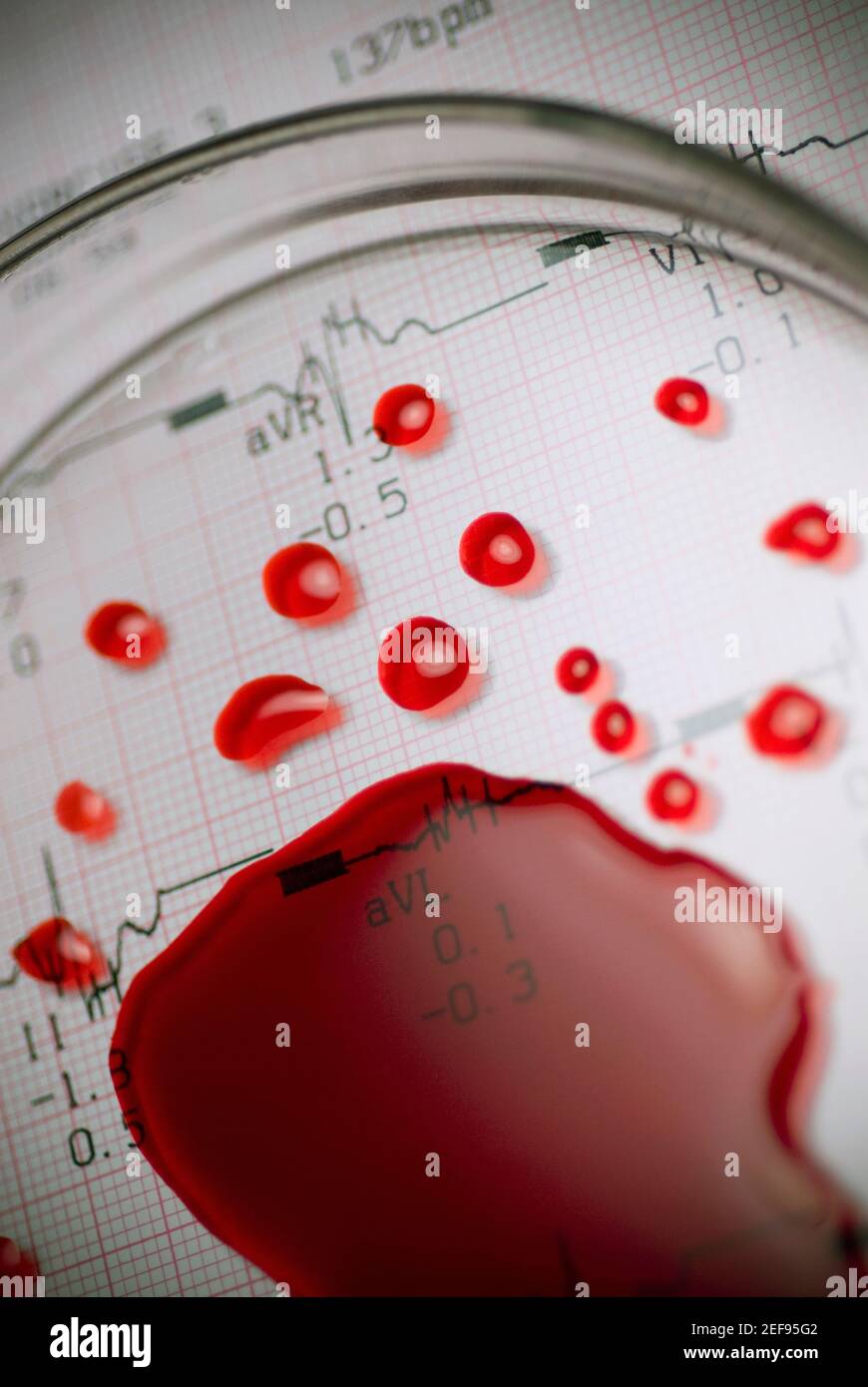 Close up di una lente di ingrandimento sulle cellule del sangue Foto Stock