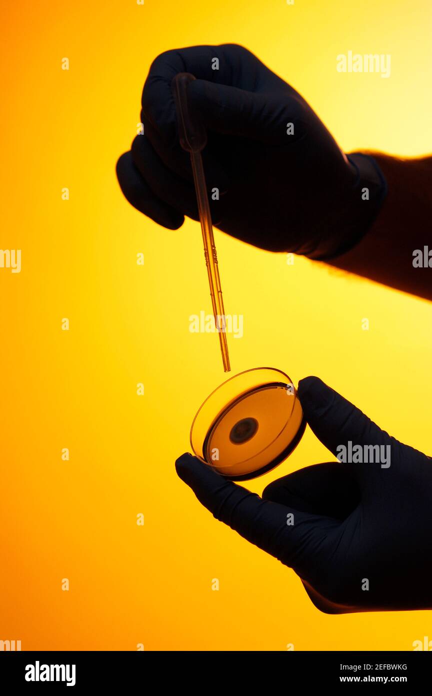 Primo piano di un contagocce e di una capsula di Petri in un personÅ½s mano Foto Stock