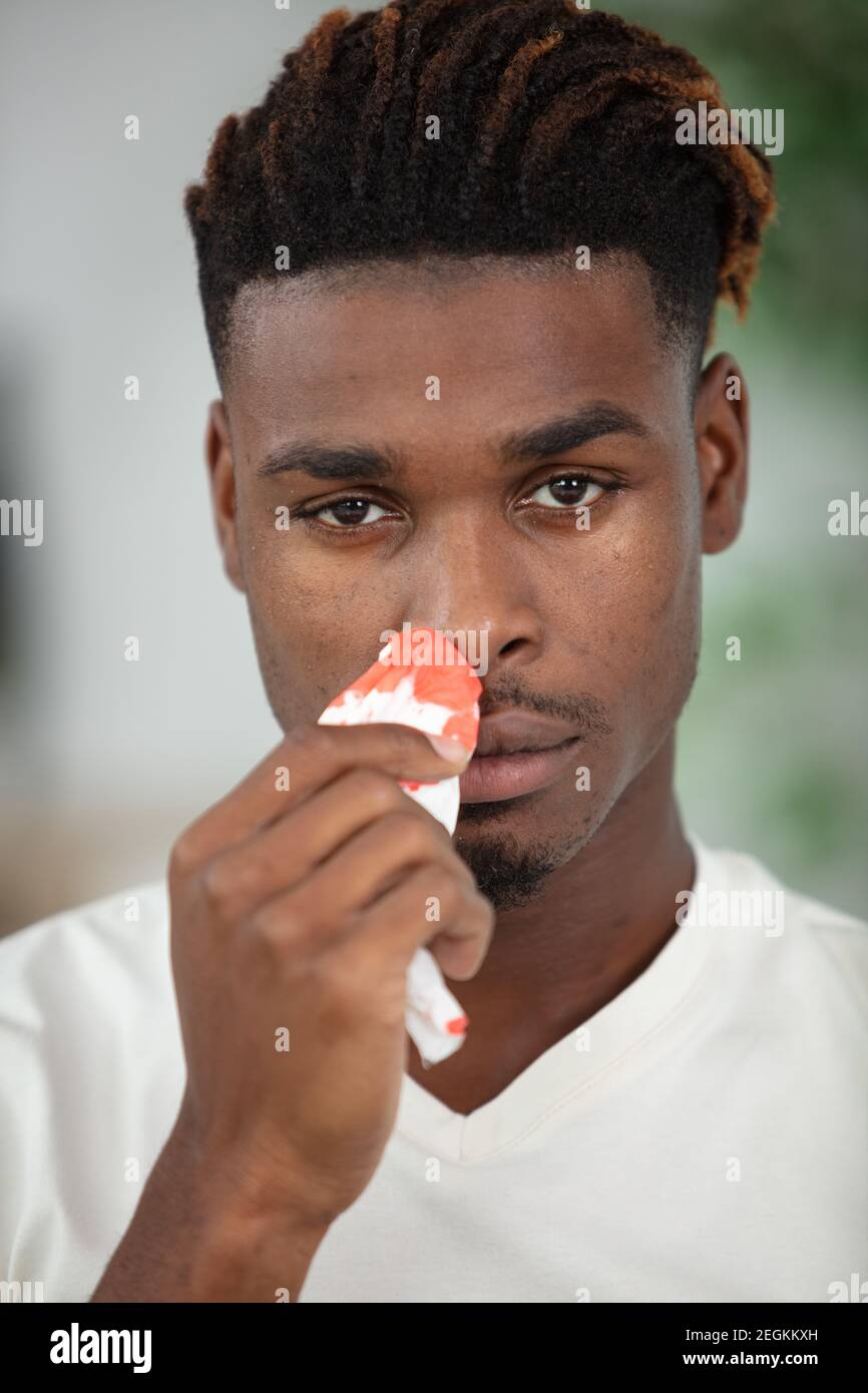 giovane uomo guarire a casa dopo chirurgia plastica naso Foto Stock