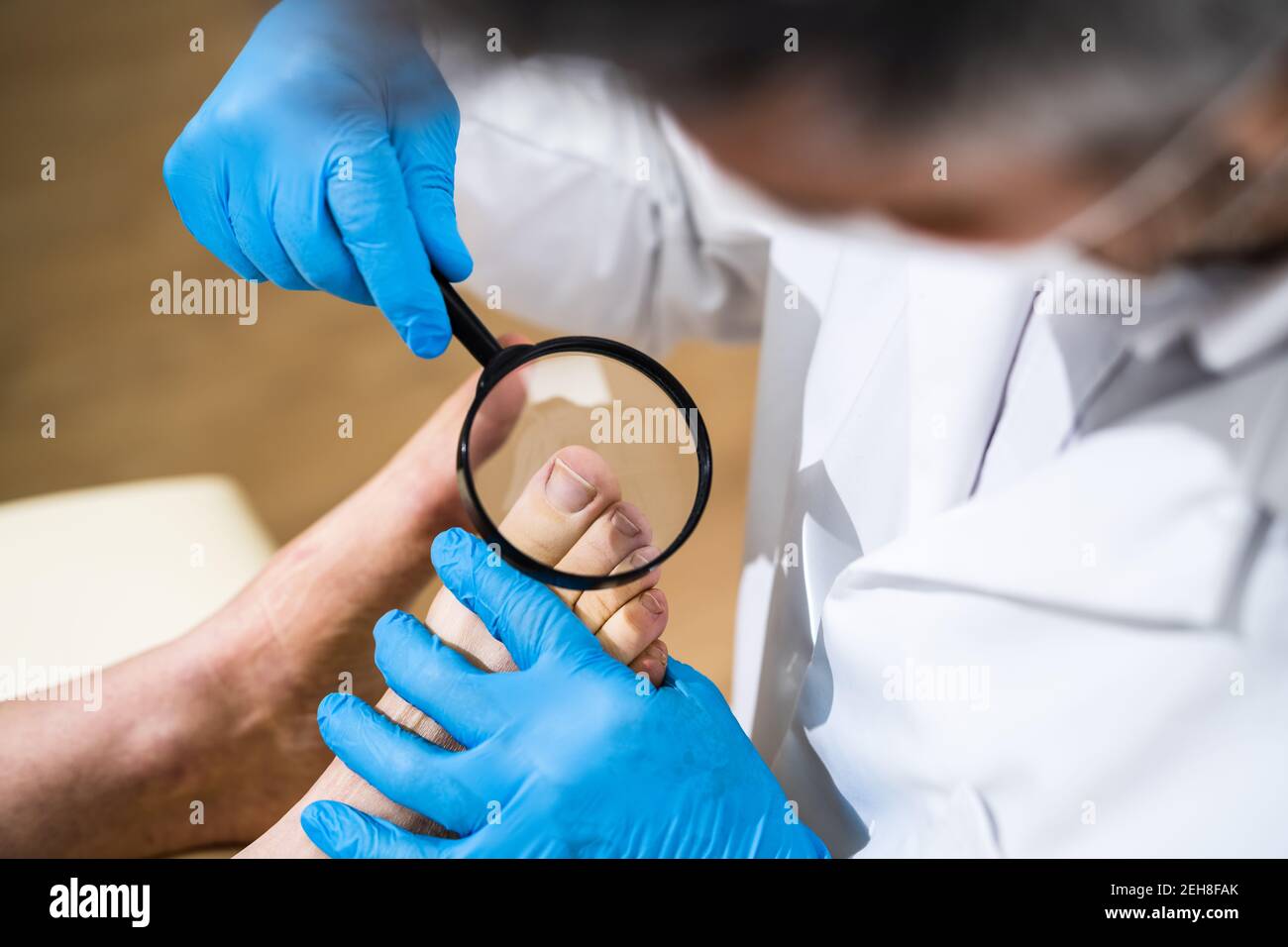 Problema di coda di rondine. Controllo del piede del paziente infetto Foto Stock