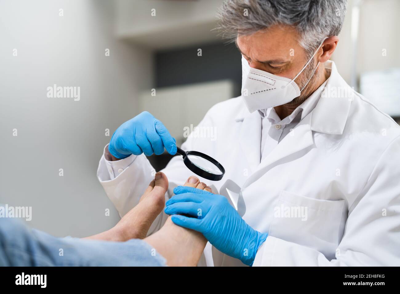 Problema di coda di rondine. Controllo del piede del paziente infetto Foto Stock