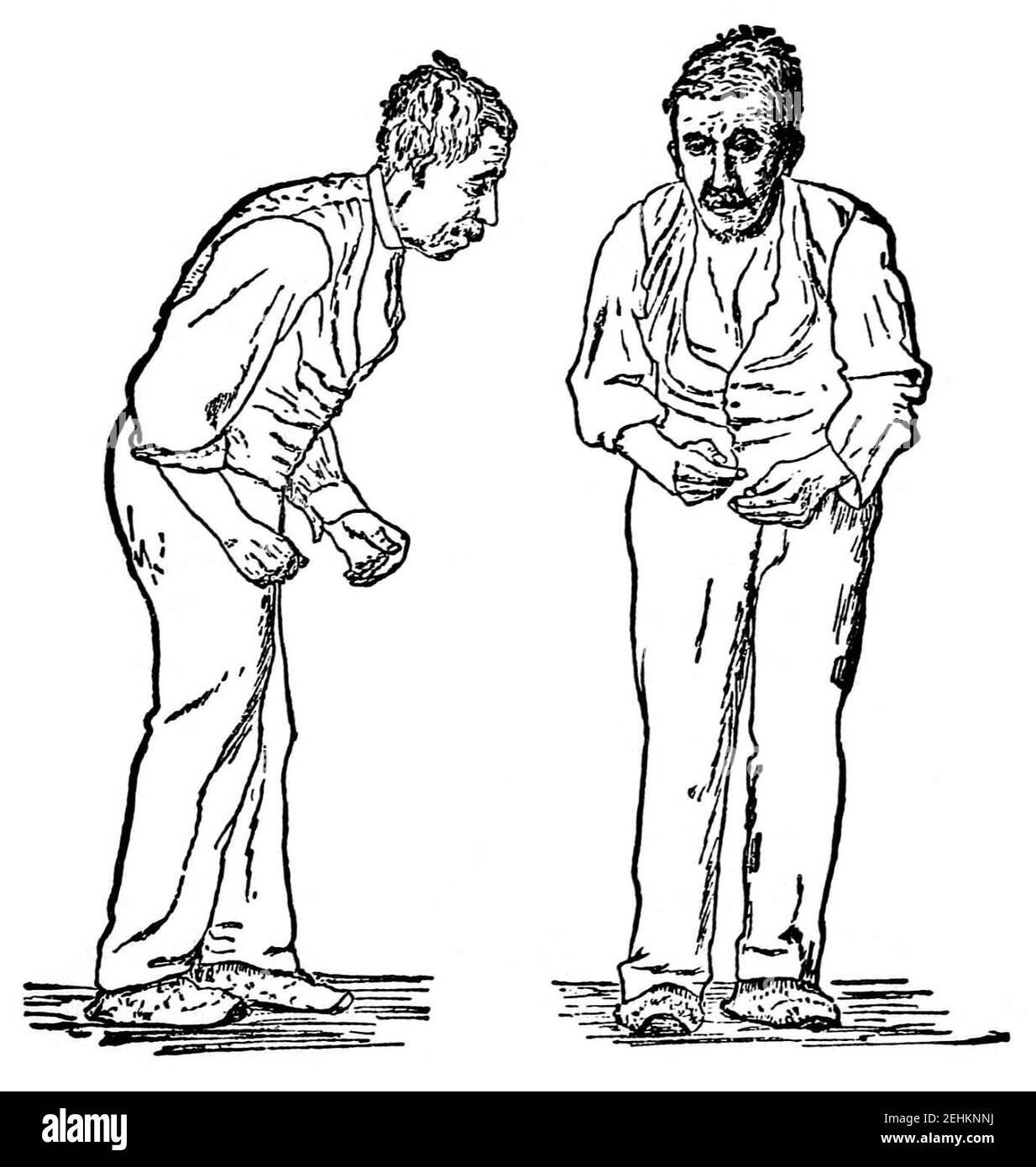 Paralisi agitans (1907, dopo St. Leger). Foto Stock