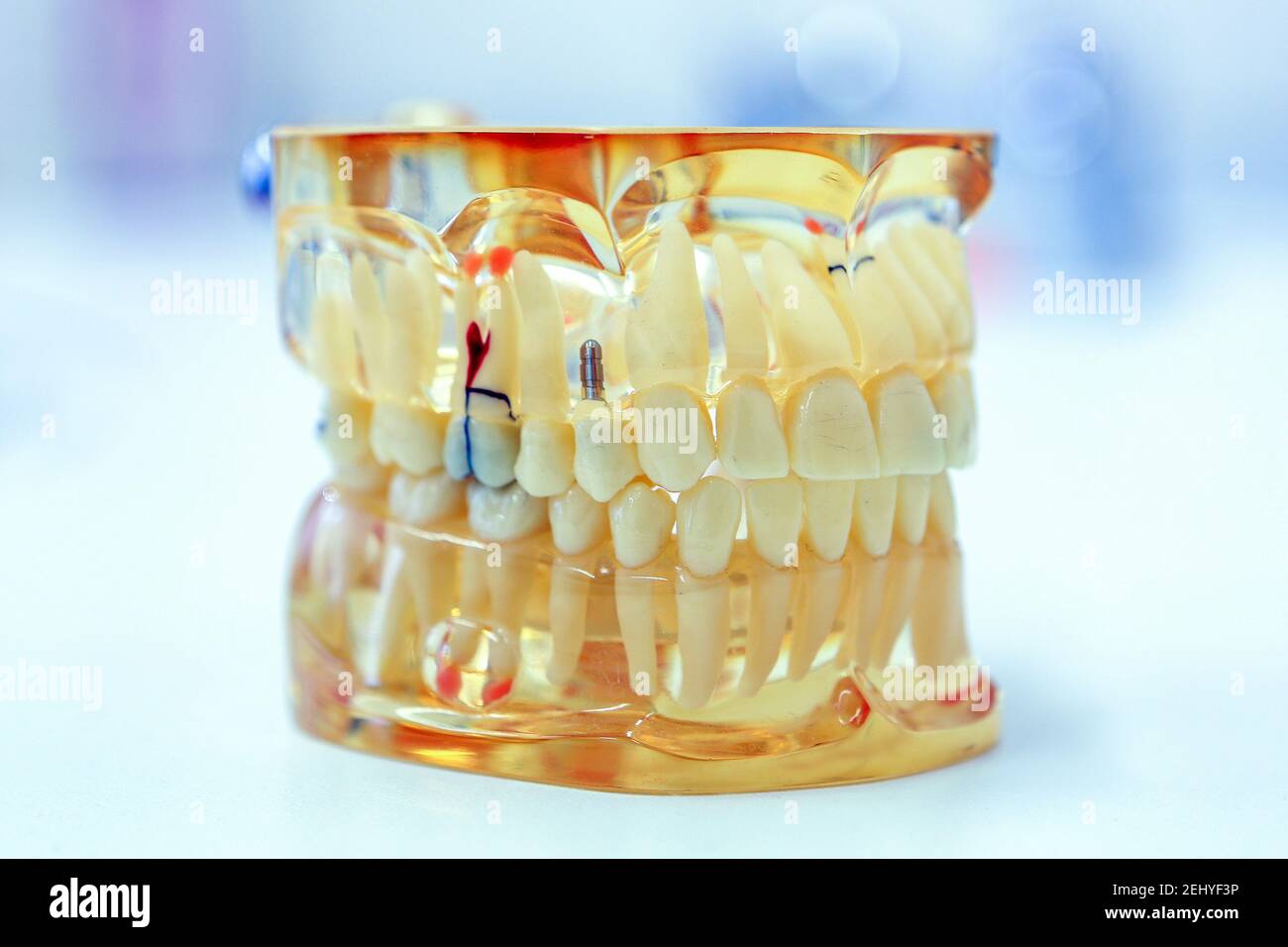 Un'anatomia trasparente dei denti umani Foto Stock